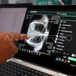 Langkah Nyata Wujudkan Pesantren Sehat Bebas TBC