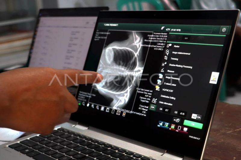 Langkah Nyata Wujudkan Pesantren Sehat Bebas TBC